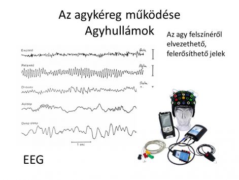 eeg.jpg